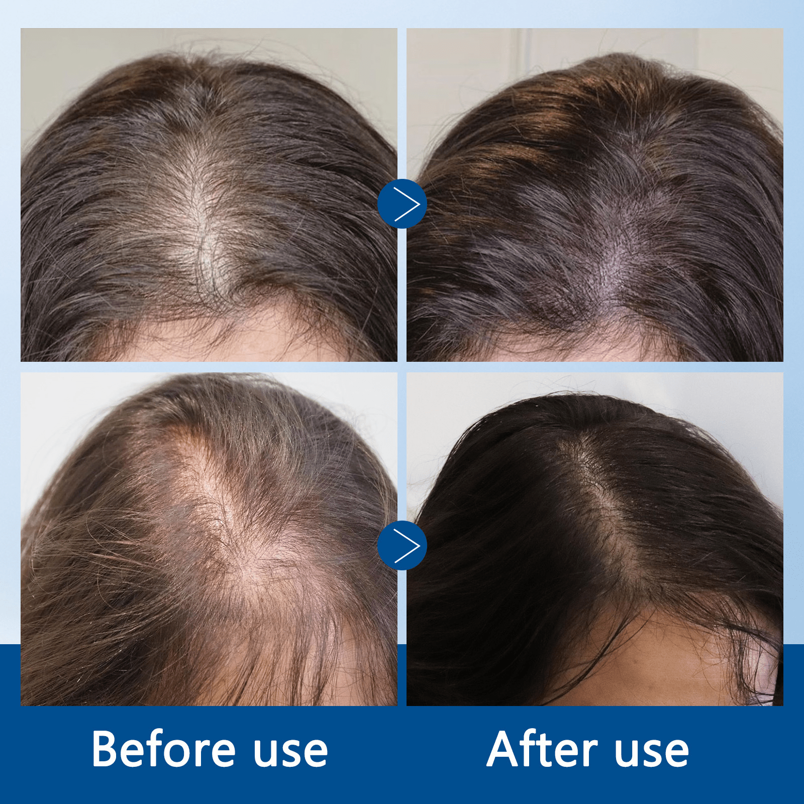 Peauhaut - Hair Grow Roll on.. - PEAUHAUT